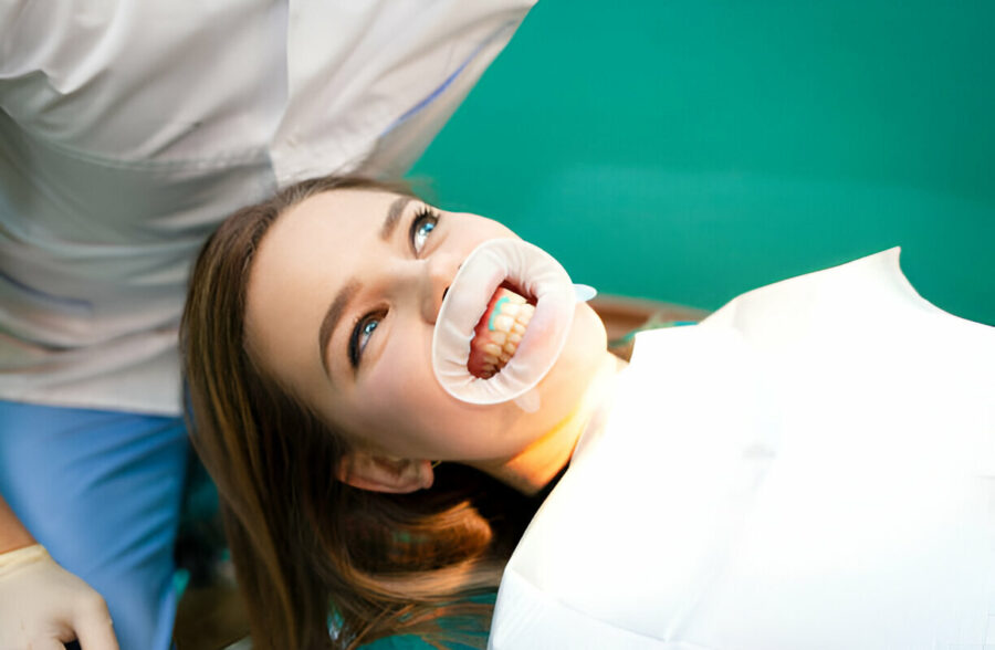 The Science Behind Teeth Whitening Gel: How It Works and Why It's Effective_3