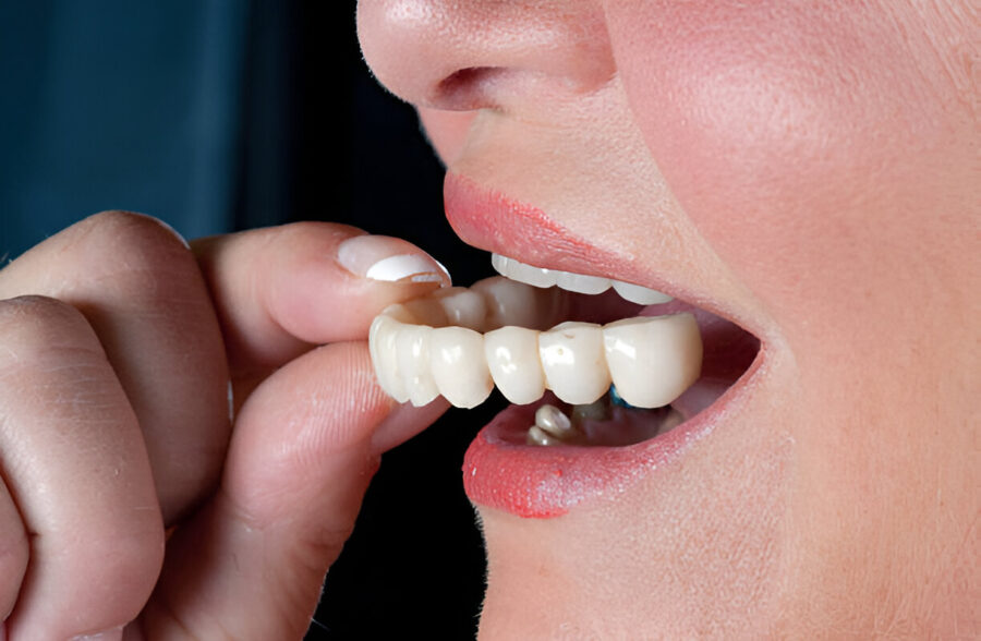 Immediate Dentures: The Quick Solution to Tooth Loss_FI