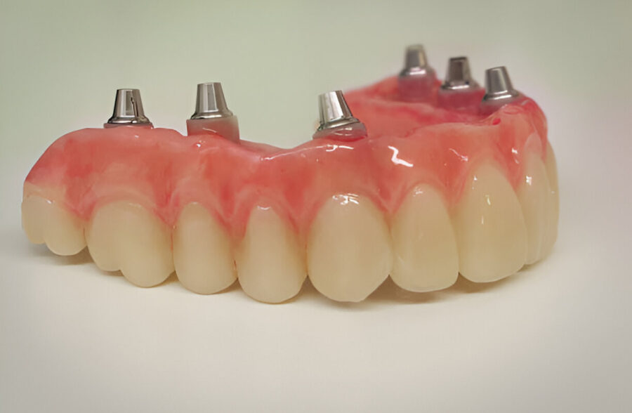 Expert Denture Care from Branson Family Dental in Branson MO: A Complete Guide_FI